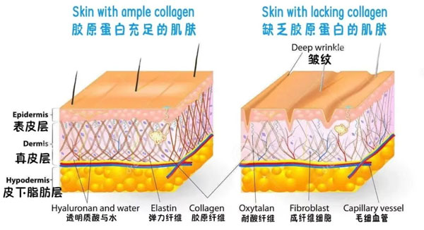 胶原卵白,增补胶原卵白,胶原卵白肽