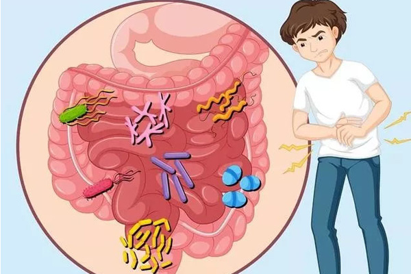 肠易激综合症,什么是肠易激综合症,怎样治疗肠易激综合症
